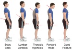 image comparing normal posture to various common compensations